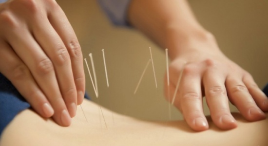 جربي الوخز بالإبر لاستعادة تدفق طاقة الحياة