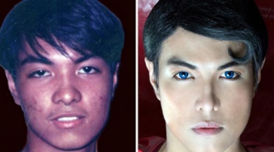 بالصور: 13 عملية جراحية تحول فلبيني الى "سوبر مان"