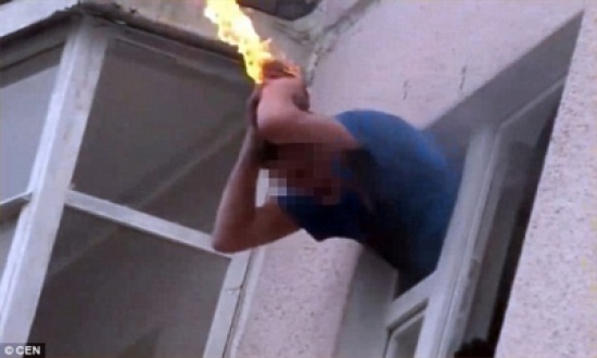 بالصور.. لحظة إنقاذ رجل اشتعلت النيران في رأسه