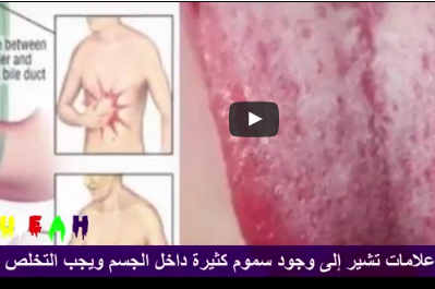 شاهد.. كيف تعرف ان جسمك يعاني من تجمع السموم