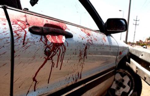 يبلغ من العمر 6 سنوات..طفل يقضي دهسا في الرمثا يبلغ من العمر 6 سنوات..طفل يقضي دهسا في الرمثا