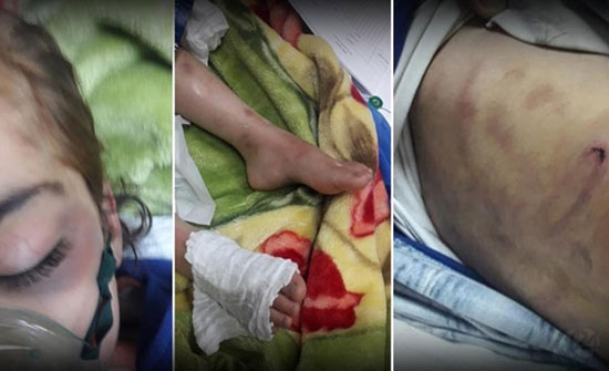 بالصور : موت طفلة يهز بغداد.. حرق وصعق وكي على يد زوجة أبيها بالصور : موت طفلة يهز بغداد.. حرق وصعق وكي على يد زوجة أبيها