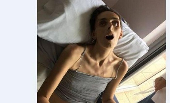 حكاية صورة صادمة نشرها زوج بعد وفاة زوجته بالسرطان حكاية صورة صادمة نشرها زوج بعد وفاة زوجته بالسرطان