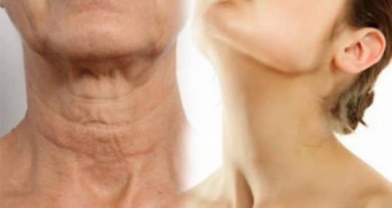 حيَل بسيطة لاستعادة شباب عنقكم! حيَل بسيطة لاستعادة شباب عنقكم!