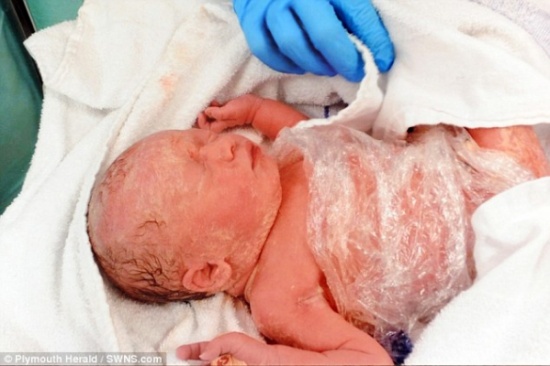 بالصور.. طفلة في رحم أمها تخضع لجراحة في العمود الفقري