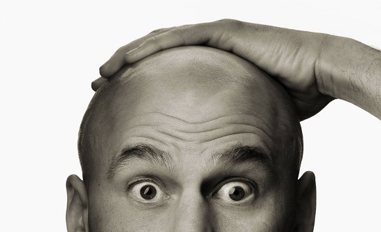 رابطة الصلعان.. أردنيون يحلقون شعورهم منزليا