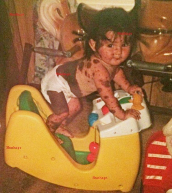 صور| ولدت وهي مغطاة بمئات الوحمات.. شاهدوا كيف أصبحت بعد 19 عاماً!