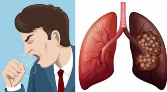 مكوّن واحد لعلاج 5 أمراض خطيرة.. يوجد في مطبخك! مكوّن واحد لعلاج 5 أمراض خطيرة.. يوجد في مطبخك!