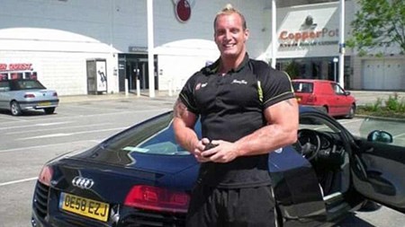 بالصور.. بعد مشاهدة ماذا حل بهذا الرجل لن تتناول المنشطات الرياضية أبداً بالصور.. بعد مشاهدة ماذا حل بهذا الرجل لن تتناول المنشطات الرياضية أبداً