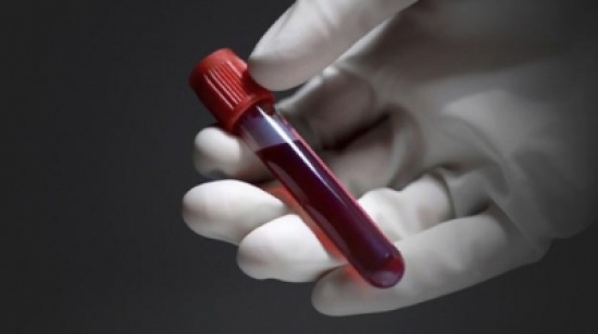 دراسة: تحليل الدم يمكن أن يتنبأ بعمرك دراسة: تحليل الدم يمكن أن يتنبأ بعمرك