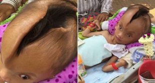 فيديو: حالة هذا الصغير اصابت الجميع بالذهول! فيديو: حالة هذا الصغير اصابت الجميع بالذهول!