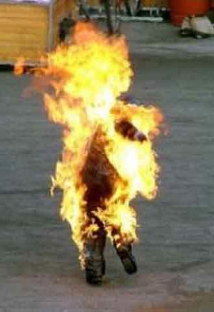 وفاة امرأة متأثرة بحروق اصابتها 