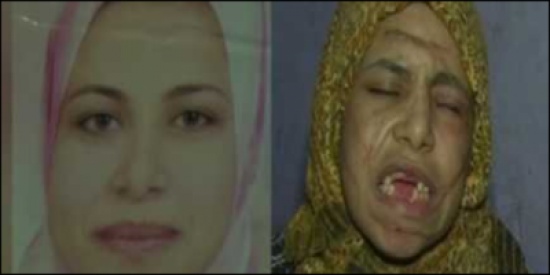 فيديو| زوج يخلع أسنان زوجته بالكماشة و يشوّه وجهها بالسكين