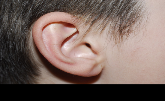 بالفيديو: ازالة قطنة تنظيف علقت في أذن مريض لعامين