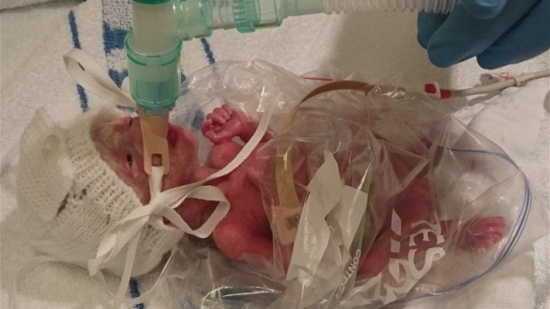 بالصور.. لماذا وُضعت الطفلة داخل كيسٍ بلاستيكي بعد ولادتها؟