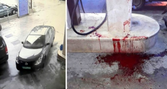 جريمة بشعة في لبنان .... اختلفا على تعبئة البنزين فأطلق النار على رأسه واقتلع عينه !! " فيديو " جريمة بشعة في لبنان .... اختلفا على تعبئة البنزين فأطلق النار على رأسه واقتلع عينه !! " فيديو "