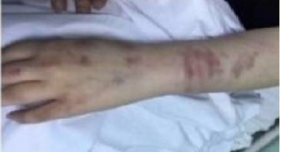 بالصور..سيدة سعودية تتعرض لتعنيف وحشي من خطيبها..!! بالصور..سيدة سعودية تتعرض لتعنيف وحشي من خطيبها..!!