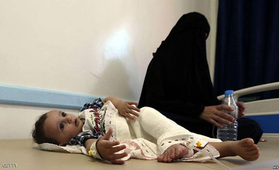 مئات الآلاف من المصابين بالكوليرا باليمن.. وتحذير من الأسوأ