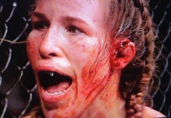 ملاكمة تتمزق أذنها.. وتتابع المباراة