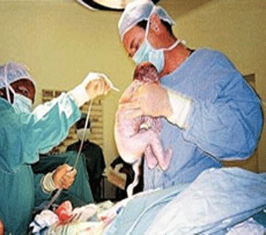 اماراتية تنجب طفلاً بعد ‬12 حالة إجهاض متكررة على مدار ‬11 عاما