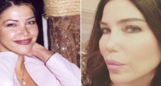 بالصور: فنانات قبل وبعد التجميل.. لن تصدّقوا الفرق بالصور: فنانات قبل وبعد التجميل.. لن تصدّقوا الفرق