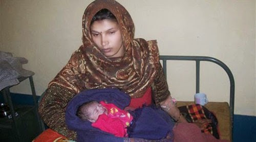 طفل هندي يولد بقلب خارج جسده