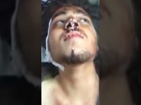 شاهد ما يقول شهيد في سكرات الموت " فيديو "