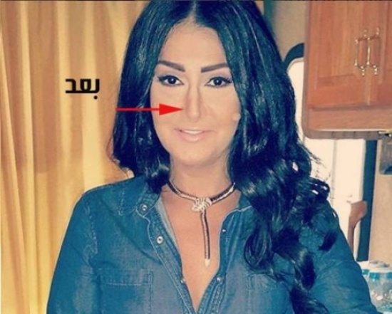 صور صادمة لغادة عبد الرازق قبل التجميل! صور صادمة لغادة عبد الرازق قبل التجميل!