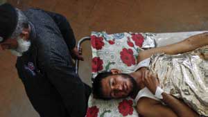 مقتل ستة أشخاص في انفجار انتحاري مروع بمستشفى عسكري في كابول