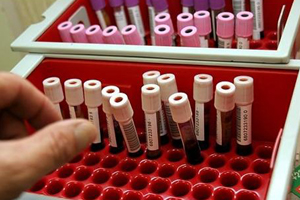 تحليل دم يتنبأ بالمتبقي من عمر الإنسان