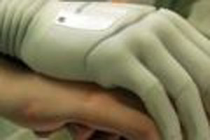 بتر يده ليحصل على يد آلية