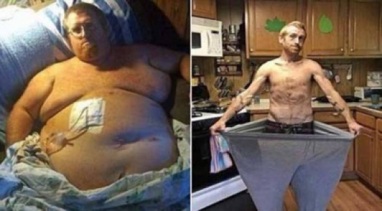 فقد 170 كيلو من وزنه بعد أن شارف على الموت