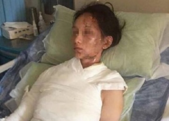 طلبت منه إضافة الماء الساخن إلى حسائها.. لكن ما فعله معها غير حياتها!