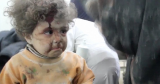 فيديو: مقطع مؤثر لطفلة مصابة من حلب في حالة ذهول وتكتم بكاءها رغم ألمها فيديو: مقطع مؤثر لطفلة مصابة من حلب في حالة ذهول وتكتم بكاءها رغم ألمها