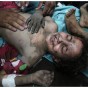 طفلة مصابة نتيجة القصف في غزة - ارشيفية