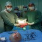 صورة من العملية التي تم خلالها استصال الورم