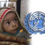 طفل يعاني من الجوع في مضايا وشعار الامم المتحدة
