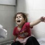 طفلة مصابة في غزة - تحت المجهر