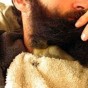 فرخ البط في لحية الرجل