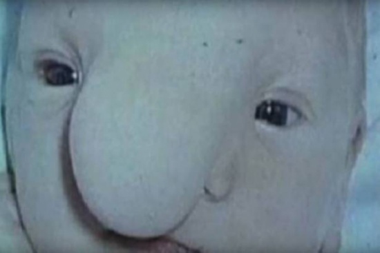 رفضته والدته بسبب 'بشاعته' .. انظروا ماذا حدث بعد 44 سنة!