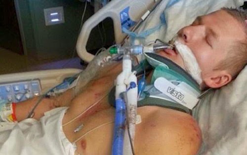 نتيجة السرعة الزائدة !!