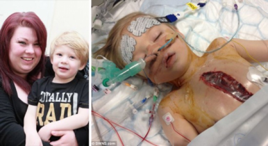 أطباء يجرون جراحة معقدة لإنقاذ طفل ولد بقلب "مقلوب"