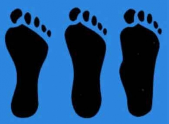"القدم المسطحة"...عيوب وأخطار