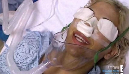 بالصور : امرأة تجري 13 عملية جراحية لتشبه إيفانكا ترامب!! بالصور : امرأة تجري 13 عملية جراحية لتشبه إيفانكا ترامب!!