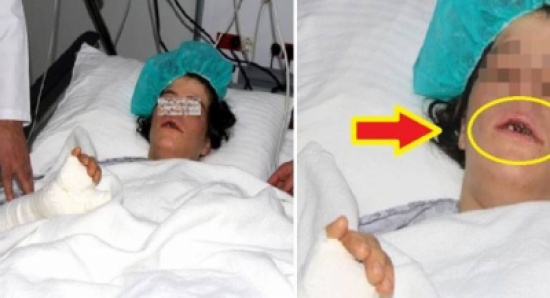 صور : اعتدى على زوجته بوحشية واقتلع أسنانها.. وهذا ما حدث لها! صور : اعتدى على زوجته بوحشية واقتلع أسنانها.. وهذا ما حدث لها!