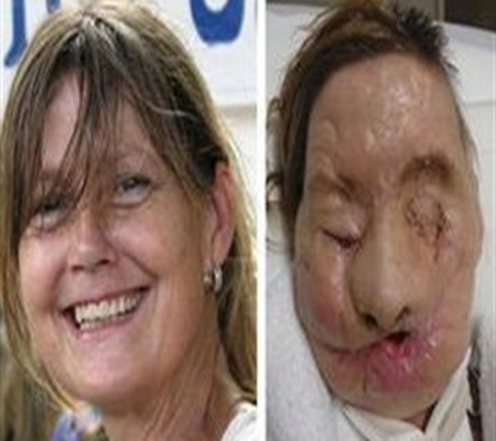 صورة فتاة صينية تبتسم للمرة الأولى منذ 12 عاما صورة فتاة صينية تبتسم للمرة الأولى منذ 12 عاما