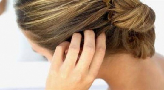 4 ظروف صحية تسبب حكّة فروة الرأس 4 ظروف صحية تسبب حكّة فروة الرأس