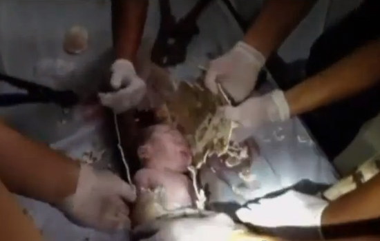 شاهدوا الطفل الذي وجدوه في المجاري ( فيديو )