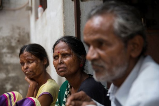 أم وابنتها تعيشان مع رجل هاجمهما بـ«ماء نار» لسبب مفجع