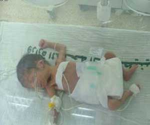 نفاذ حليب الاطفال العلاجي في قطاع غزة